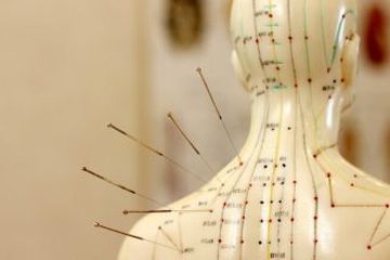 SEJARAH: 2010 Akupunktur Masuk Warisan Budaya-Image-2