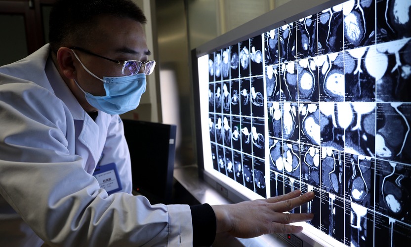 Transformasi Layanan Publik, China Wujudkan Jangkauan Kesehatan Terluas di Dunia-Image-1