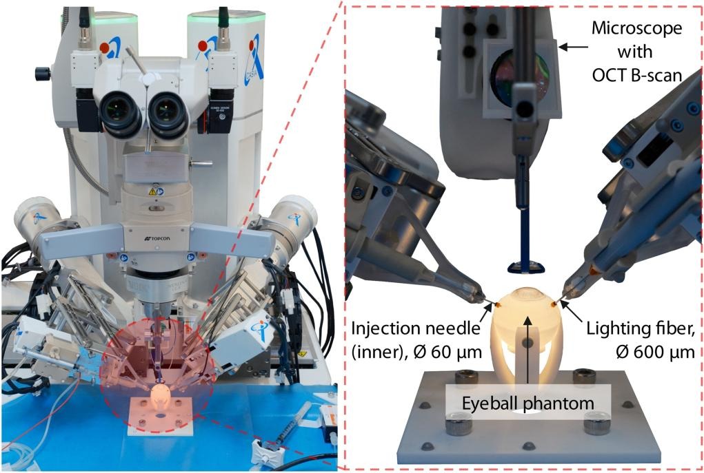Terobosan Medis, Peneliti China Kembangkan Robot Operasi Mata Otonom-Image-1 Terobosan Medis, Peneliti China Kembangkan Robot Operasi Mata Otonom-Image-1