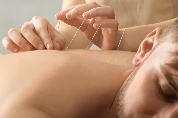 Menjelajahi TCM dan Akupunktur