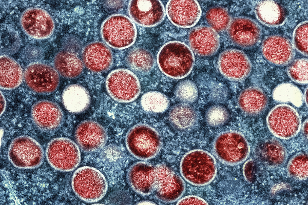 Sinopharm’s mRNA Vaccines: Effective Defense Against Monkeypox
