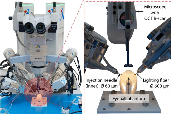 Terobosan Medis, Peneliti China Kembangkan Robot &hellip;